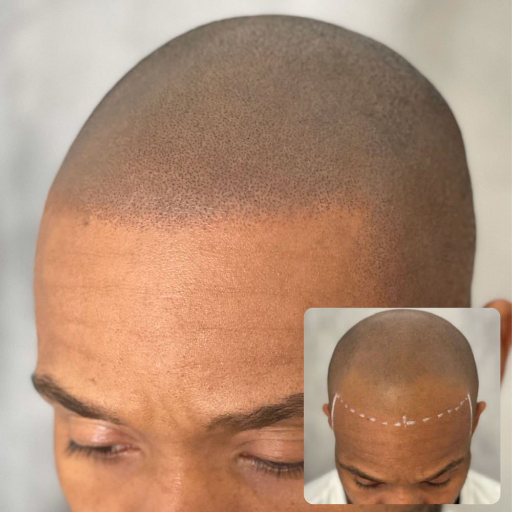 Cherry Financing before after 1000x1000 24.png